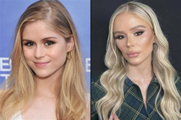 Haley Layne Plastic Surgery Before And After Pictures: All About The Hooked On The Look Star