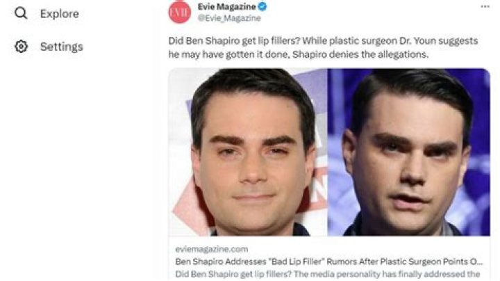 Has Ben Shapiro Received Plastic Surgery? Or Is It Makeup?