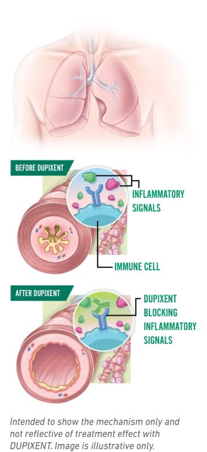 How does dupixent work