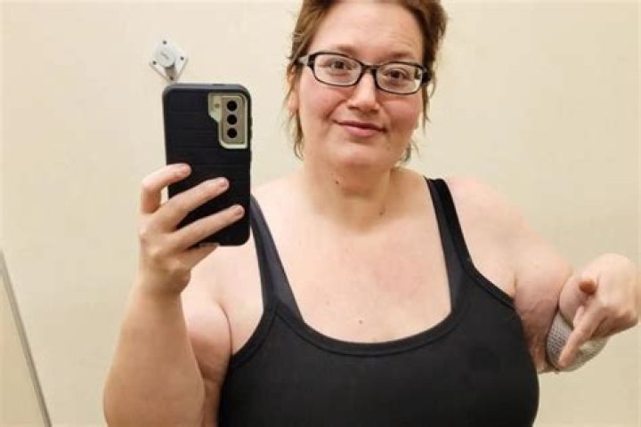 How Much Weight Has Lexi Reed Lost? Where Is She Today? Health Update As The Influencer Is Admitted To Hospital
