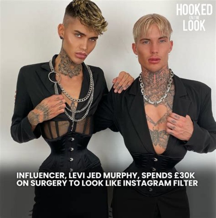 Levi Jed Murphy Before Surgery Photos and Boyfriend: Everything On Levijedmurphy TikTok Star